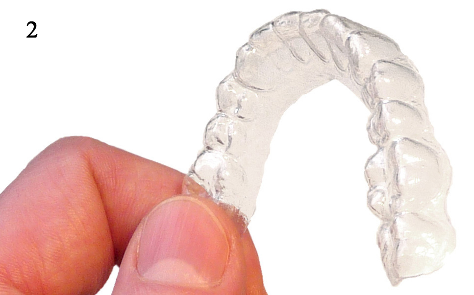 Miniplastschiene für das abnehmbare Halten der Zähne