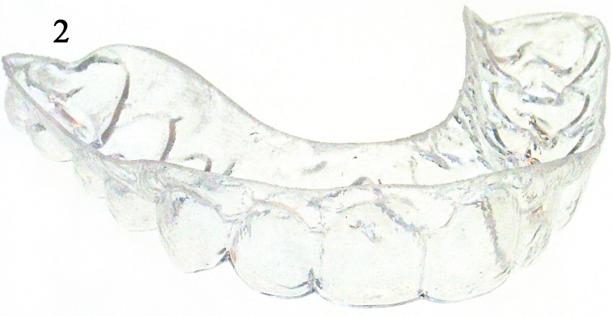 Miniplastschiene zum Halten der Zähne
